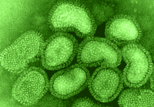  Confirmados en Costa Rica 12 los casos de influenza porcina A H1N1